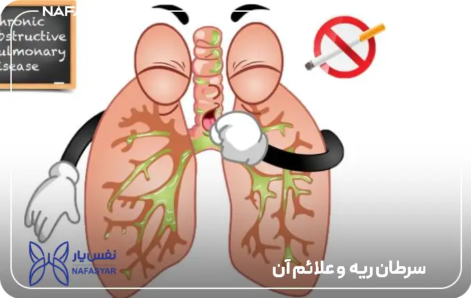سرطان ریه چیست